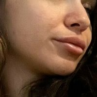 asxxo Nue