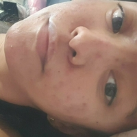 xsugarvulpesx Nue